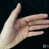 手足皲裂的预防方法都有哪些