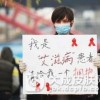 艾滋病症状表现“五花八门”