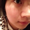 皮肤为什么会反复出现过敏