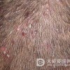 痈病人的身体不良反应