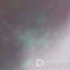 怎样减少贫血痣的发生