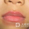 儿童异位性皮炎是怎么回事