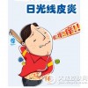 日光性皮炎注意的问题有哪些