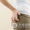 肛门瘙痒症都有哪些症状表现