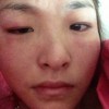 哪些食物会引起皮肤过敏