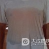 发生多汗症应该怎样调养