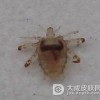 阴虱病治疗时该吃什么呢