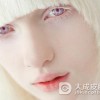 白化病患者的家属有什么工作