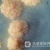 与一期梅毒患者握手会感染梅毒吗