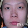 雀斑预防措施你知道吗