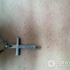 接触性皮炎预防用什么方法好