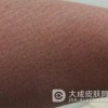 不同阶段的鱼鳞病应该怎么治疗