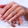 手足皲裂患者要注意哪些事项呢
