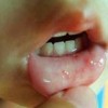 手足口病的病因都有哪些呢