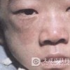 患有皮肌炎的主要病因有哪些呢