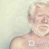 白化病疾病真的会传染吗