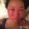 宝宝皮肤过敏的原因是什么