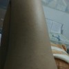 传染性软疣的病因都有什么