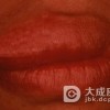 预防小儿遗传性血管神经性水肿的措施