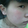 皮肤过敏都是有哪些原因引起的