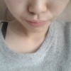 皮肤过敏的主要病因有哪些？