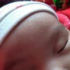 婴儿湿疹的常见原因有哪些