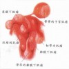 外阴黏膜白斑的发病原因