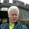 白化病患者要注意自我保护