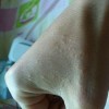 手癣手气患者最好不要亲自下厨