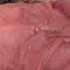 预防生殖器疱疹的方法