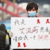 艾滋病的舌头早期症状