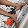 【艾滋病日】艾滋病与皮肤病的微妙之缘