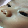 护理婴儿湿疹方法