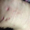 得了梅毒要注意什么
