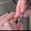 甲沟炎的护理措施有哪些啊