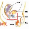 前列腺炎的预防工作有什么