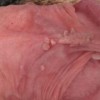 关于生殖器疱疹的日常护理须知