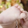 手足皲裂早期症状有哪些