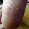预防手足癣有效的方法