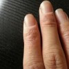 生活中预防手足癣的方法有什么呢