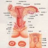 女性外阴白斑该怎么护理？