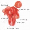 女性要注意外阴白斑的危害有什么？