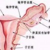 外阴黏膜白斑的鉴别疾病