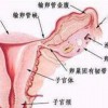 外阴白斑病有怎样的症状特点呢？