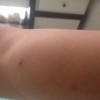 性病症状和女性性高潮缺乏
