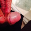 性病会有什么样的症状？
