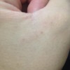 老人皮肤瘙痒症状怎么办