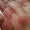 女性穿长筒靴易生冻疮