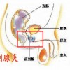 教你有效缓解前列腺炎的妙招