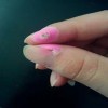 试问脚上长鸡眼是怎么回事